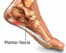 plantar